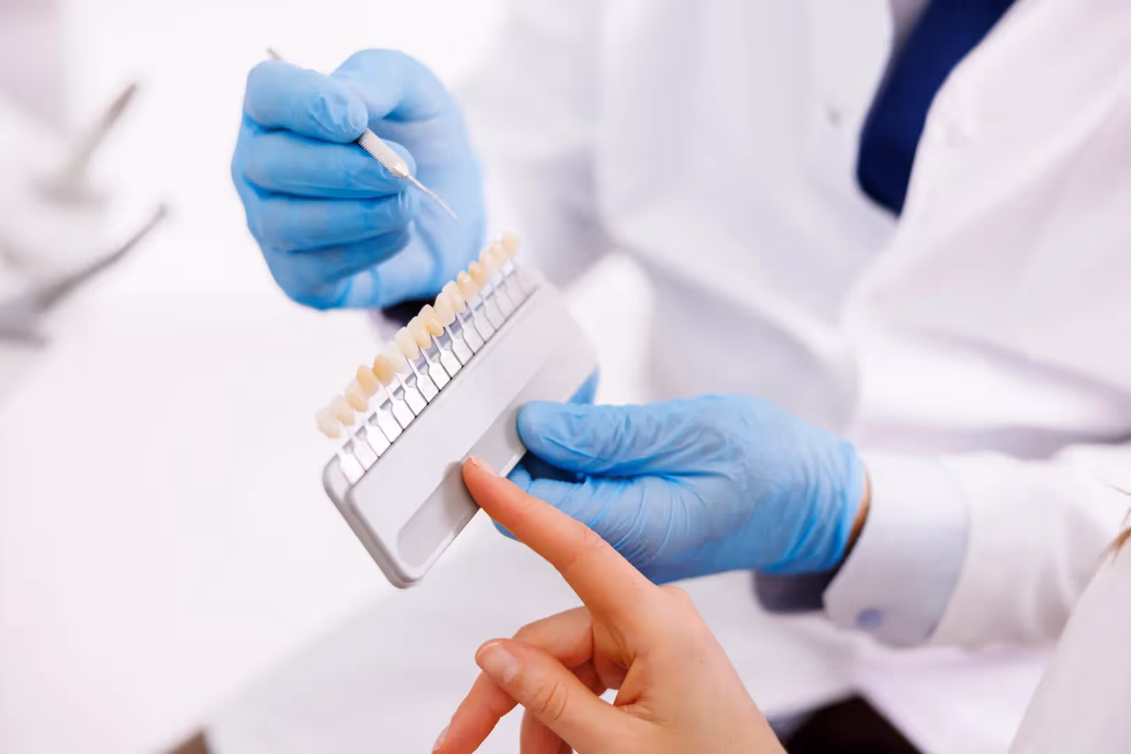Dental Veneers & Dental Laminates