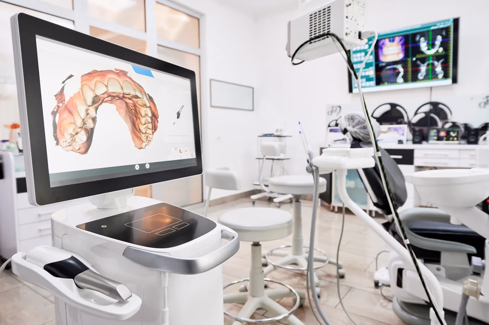 Digital dentures created with digital dentistry workflow