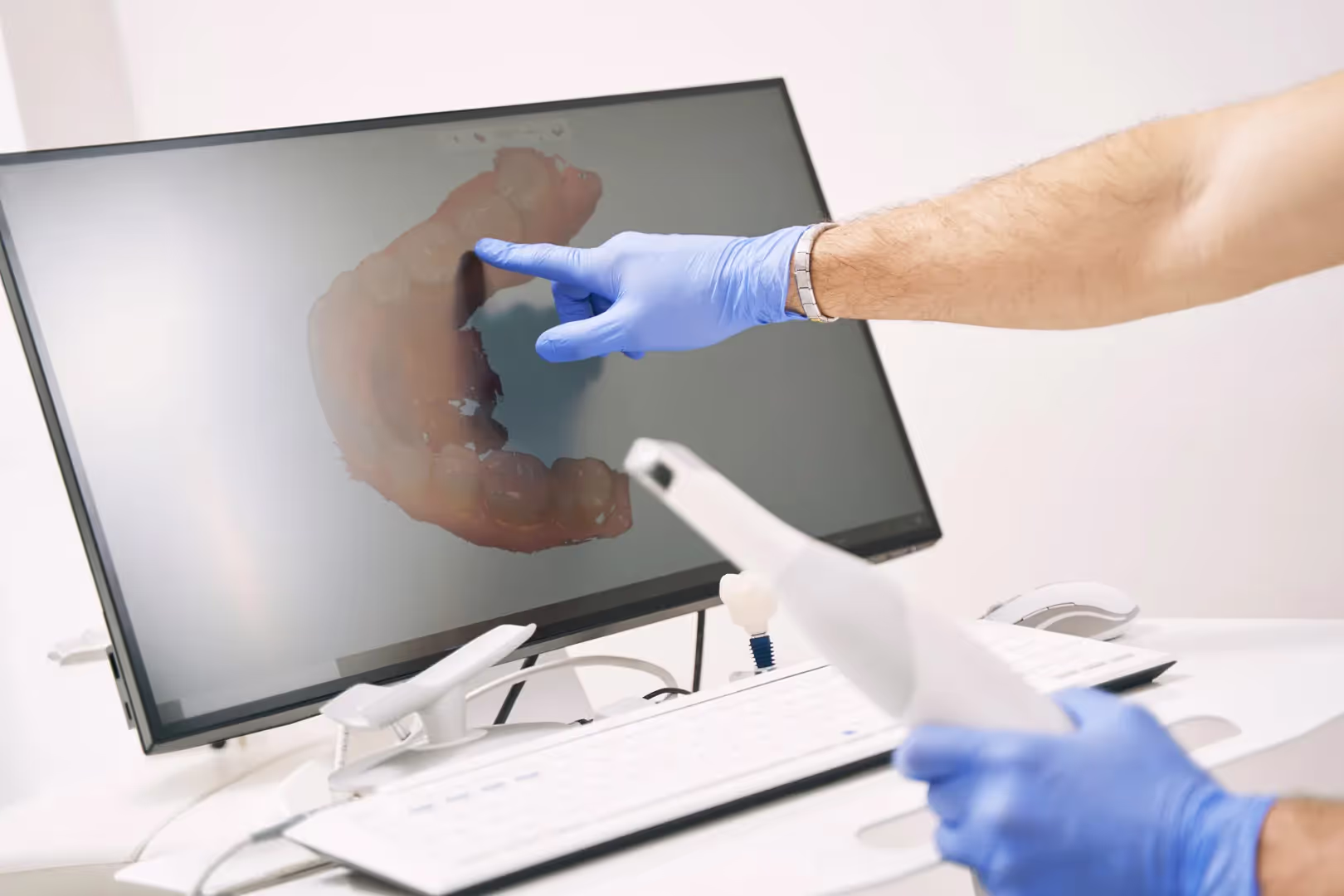 Intraoral Scanning