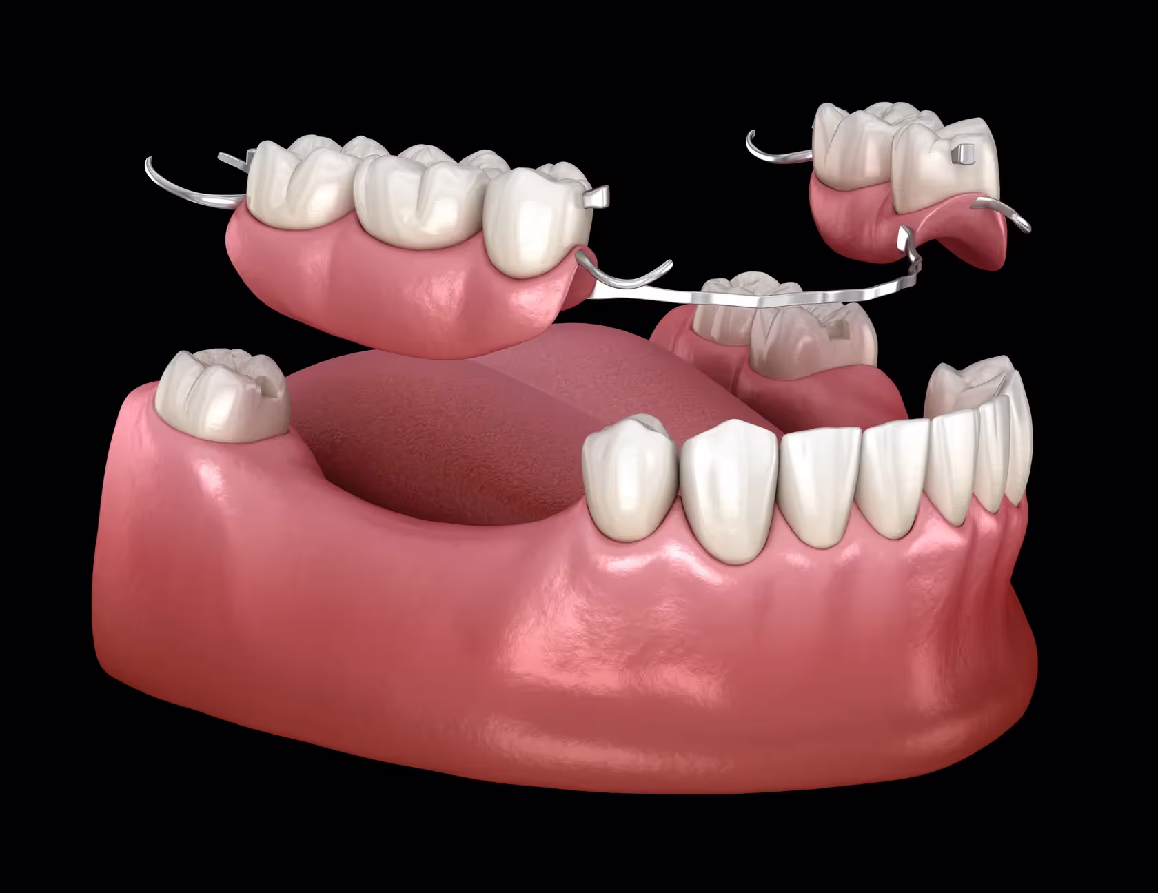 Prosthodontics